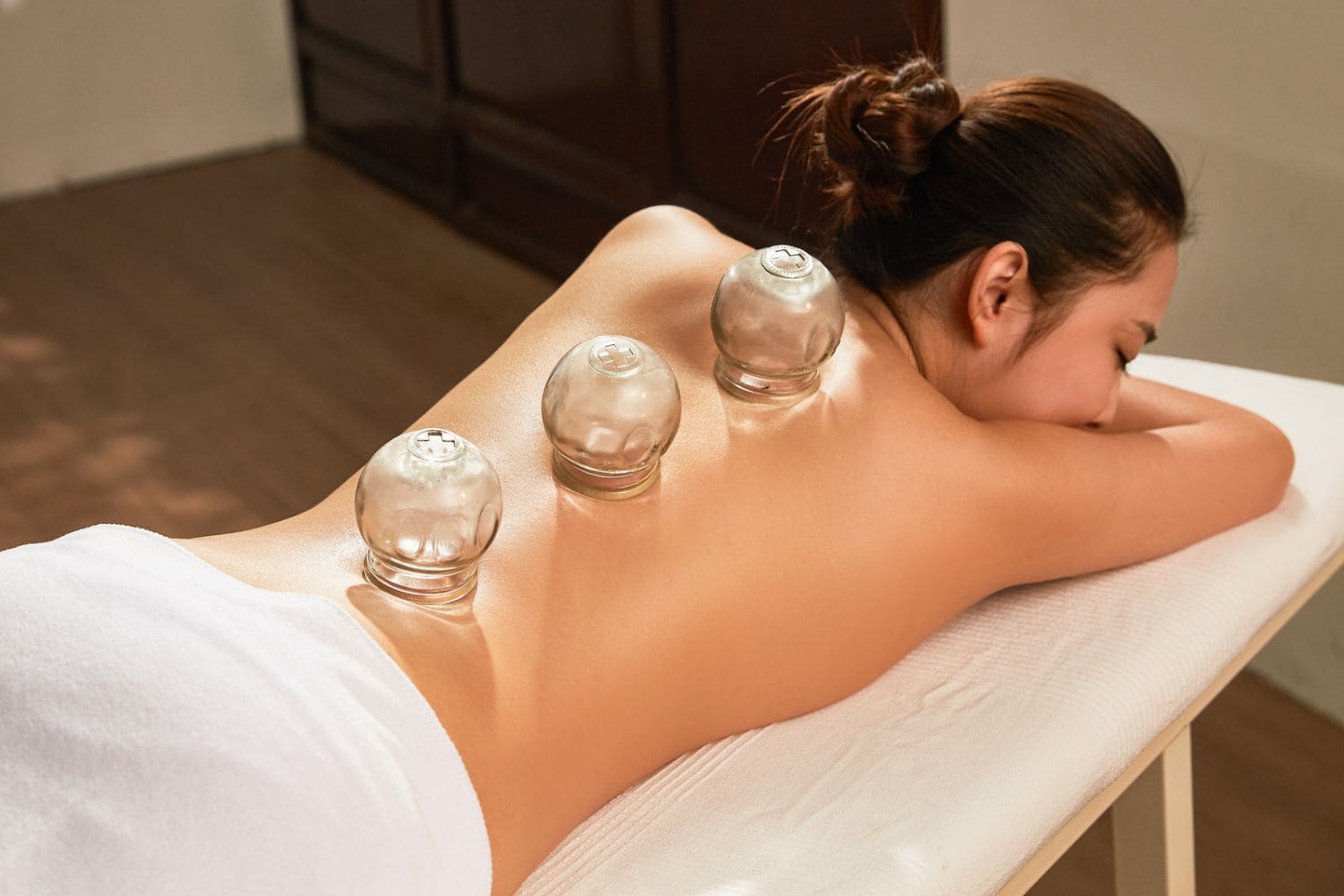 cupping
