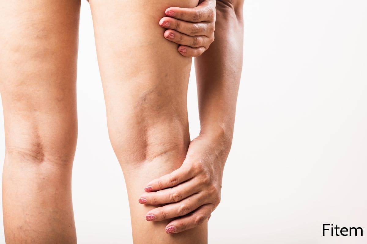 jambes douloureuses jambes douloureuses